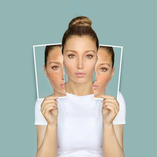 Best Skincare Products for Combination Skin