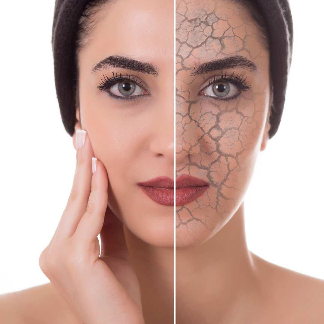 Best Skincare Products for Dry Skin
